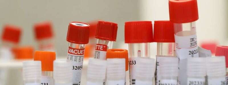 Vacuna contra la Covid-19/TA.